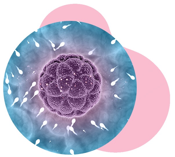 What Is Intrauterine Insemination