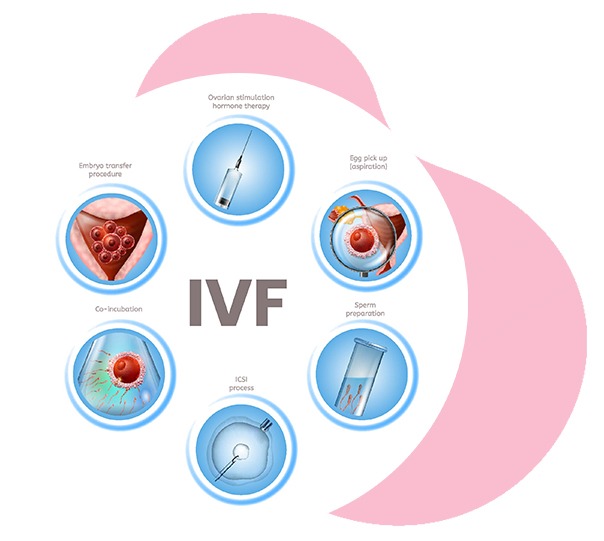 Procedure Of IVF Treatment In Ahmedabad