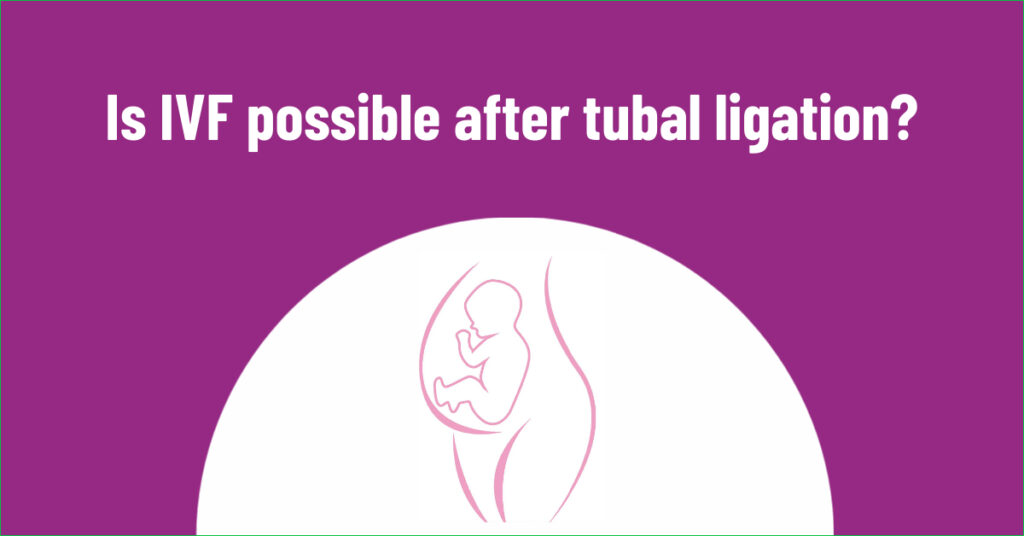 Is IVF possible after Tubal Ligation?