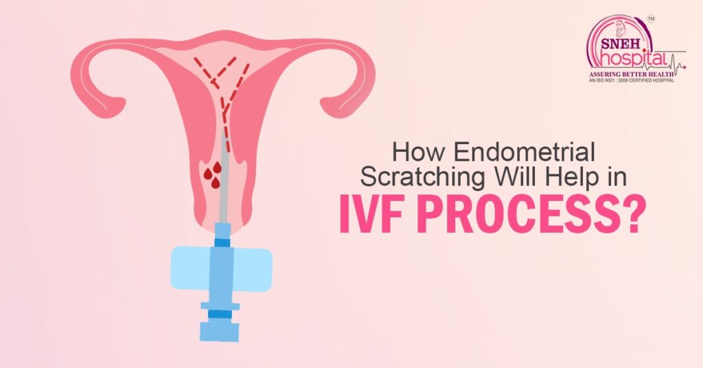 How Endometrial Scratching Will Help in IVF Process?