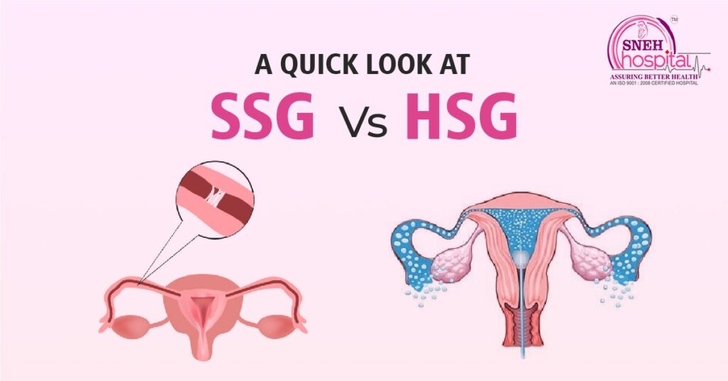 SSG Vs HSG