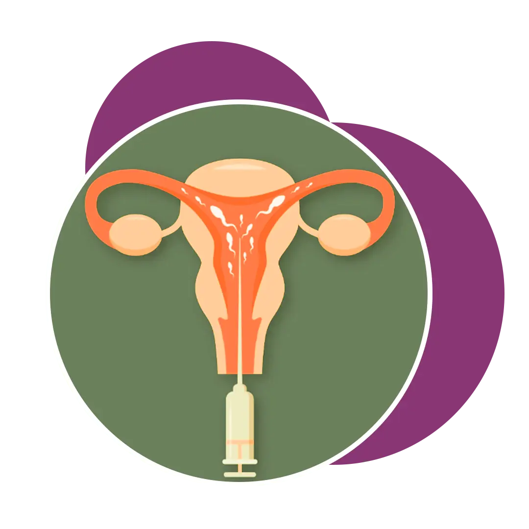 Best IUI Treatment Center In Ahmedabad