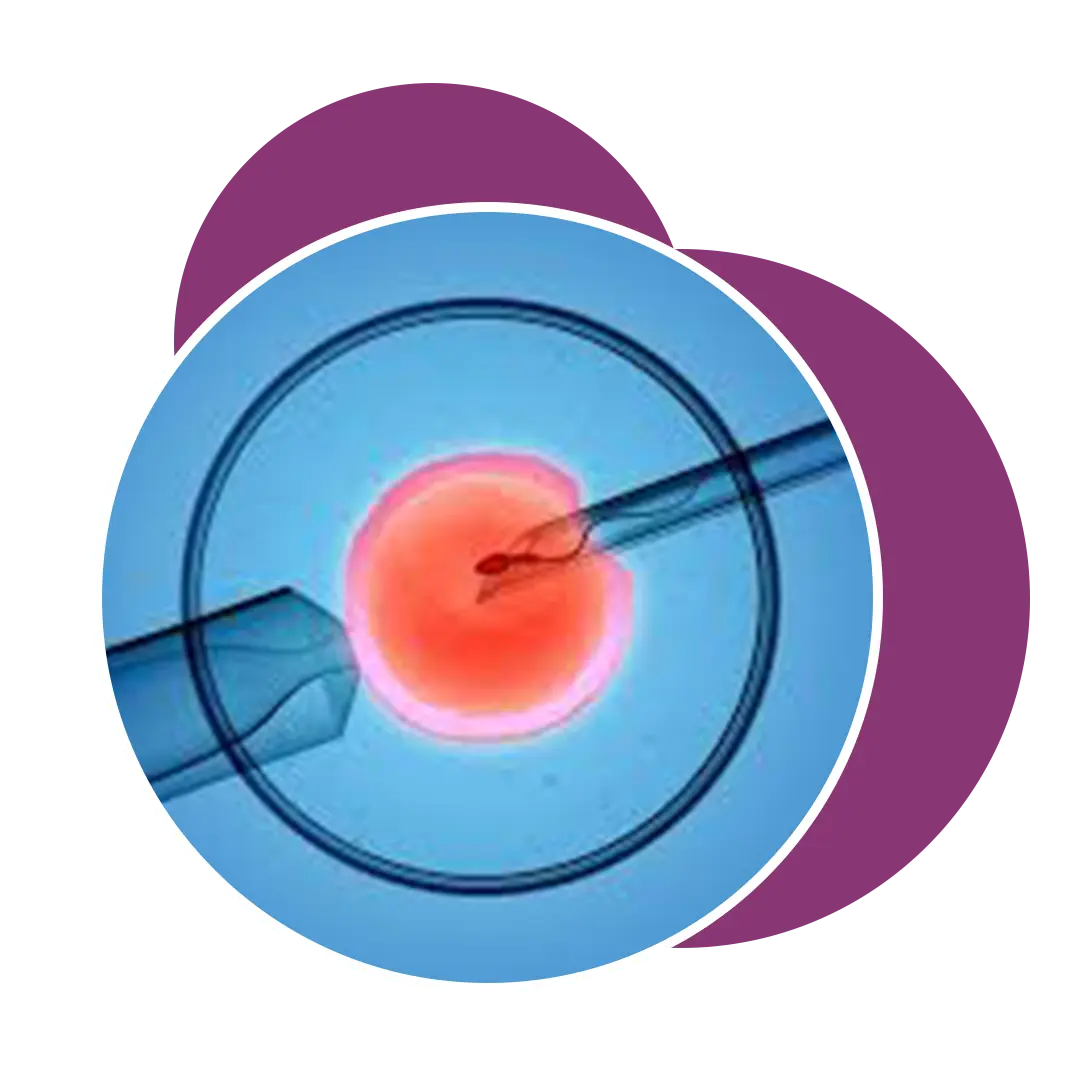 IUI Treatment In Ahmedabad