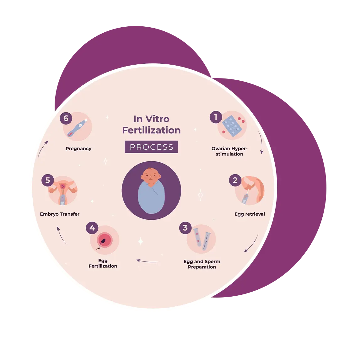 IVF Procedure In Ahmedabad