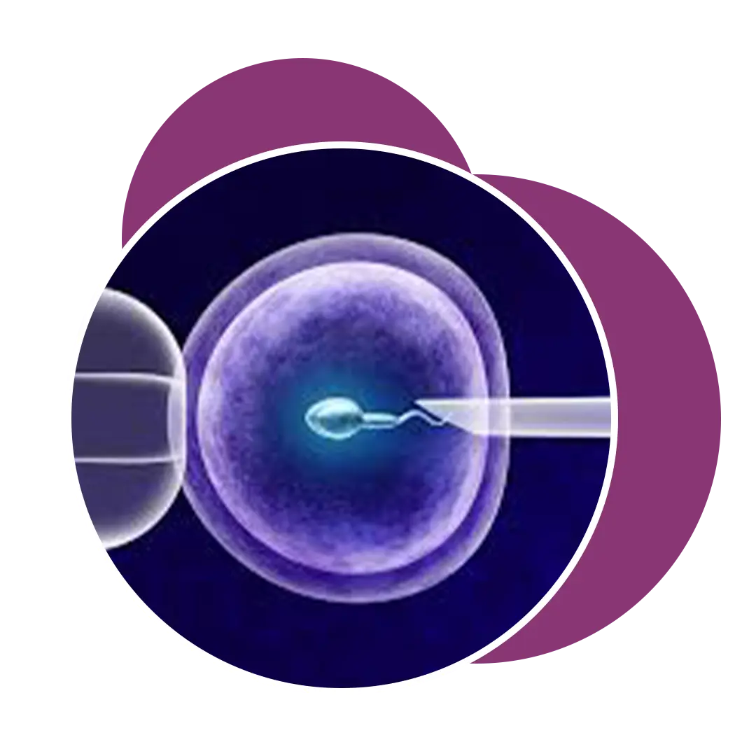 IVF Treatment In Ahmedabad